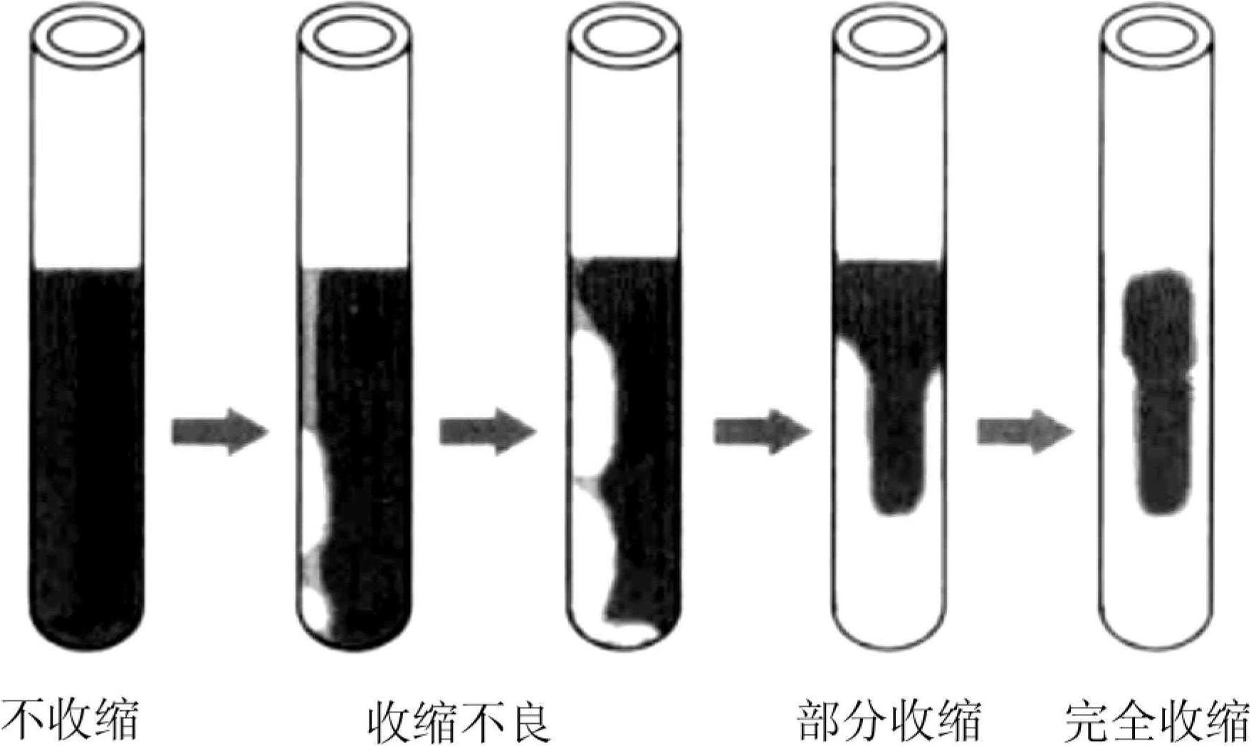 三、血小板檢驗